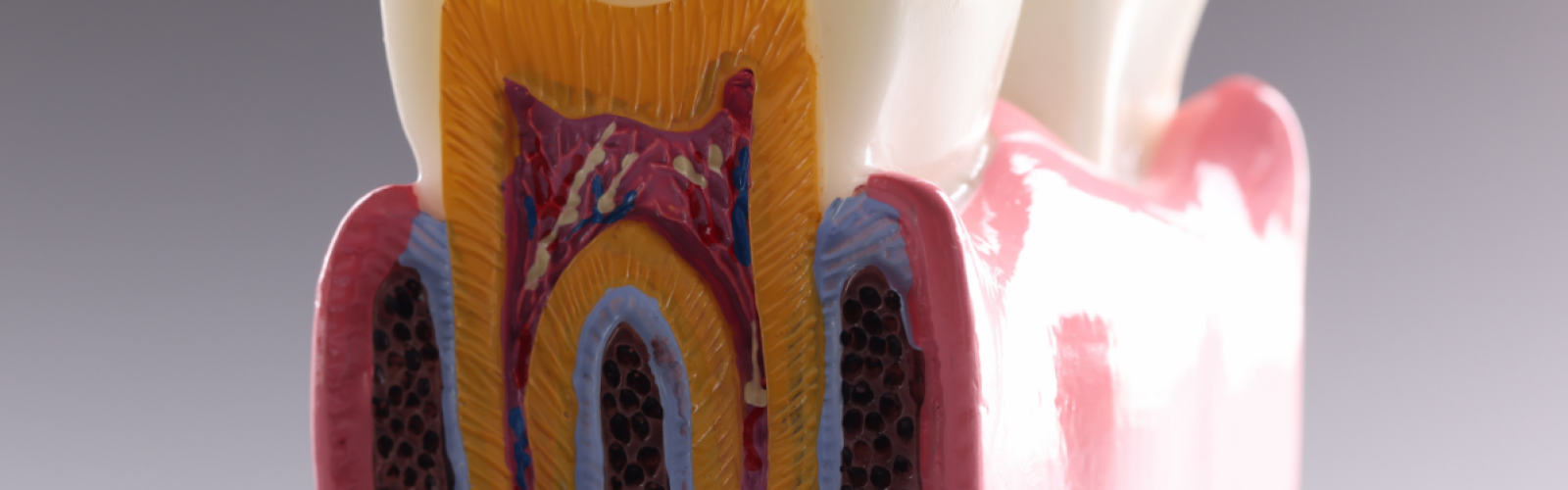 pulpite dente