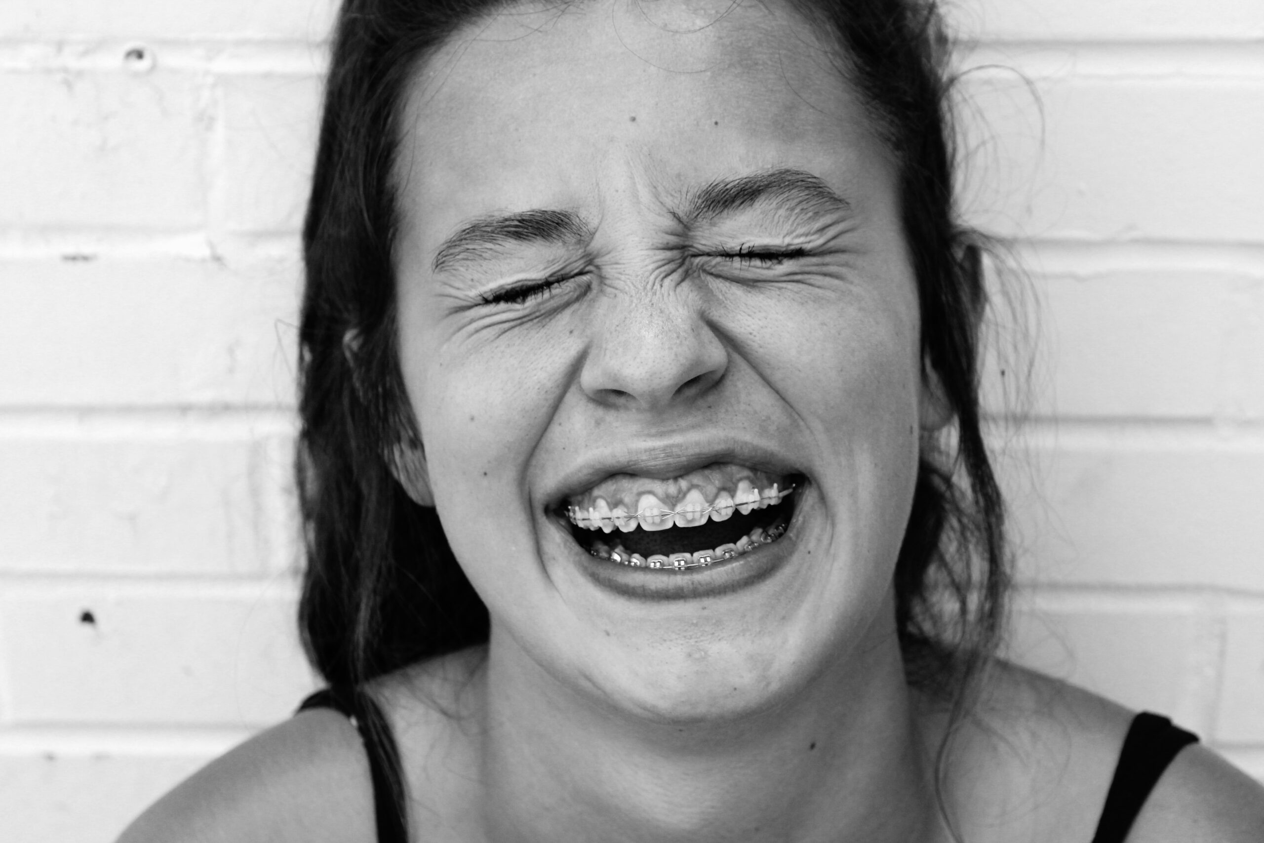 diastema - rimedi e cure