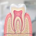 Sezione trasversale illustrata di un dente con smalto, dentina e polpa dentale evidenziata in rosa al centro, stile didattico moderno luce naturale